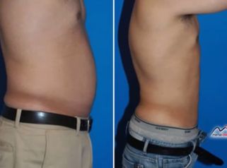 Confía sólo en expertos en cirugía estética
