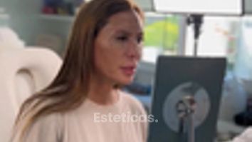 Rellenos faciales - Escobar Aesthetic Clinic