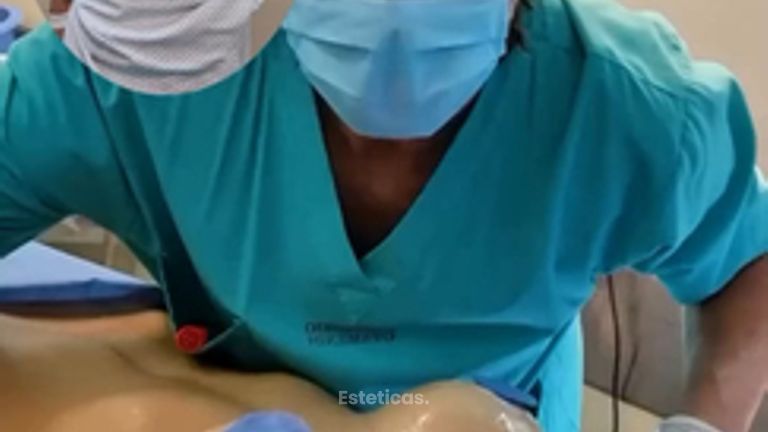 Levantamiento Mamario - Dr. Damian Galeazzo y Equipo