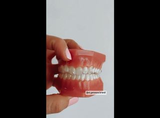 Ortodoncia invisible - Od. María Genoveva Lorandi